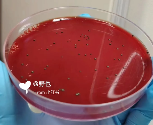 专注口腔微生物研究：迈睿可生物提供标准牙龈卟啉单胞菌菌种