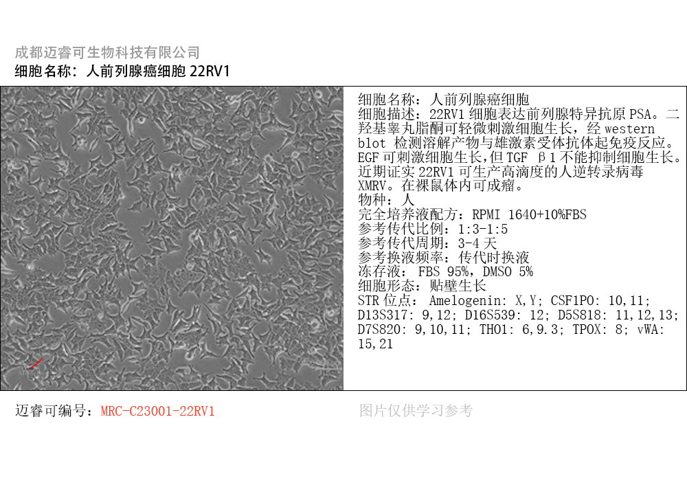 22RV1人前列腺癌细胞