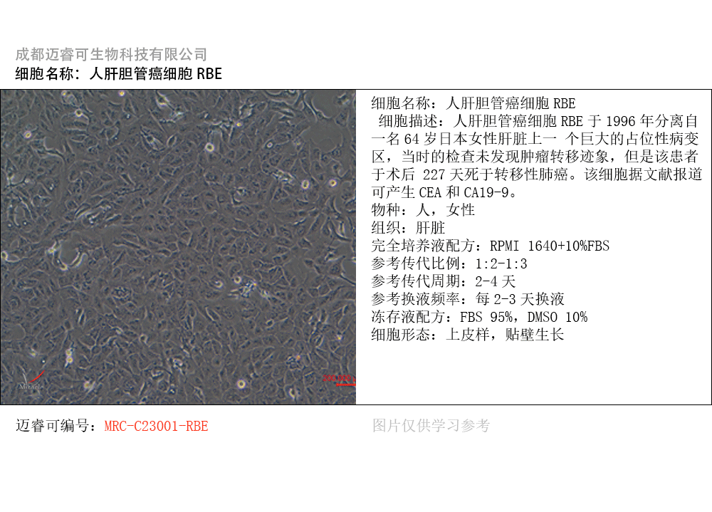 人肝胆管癌细胞RBE细胞