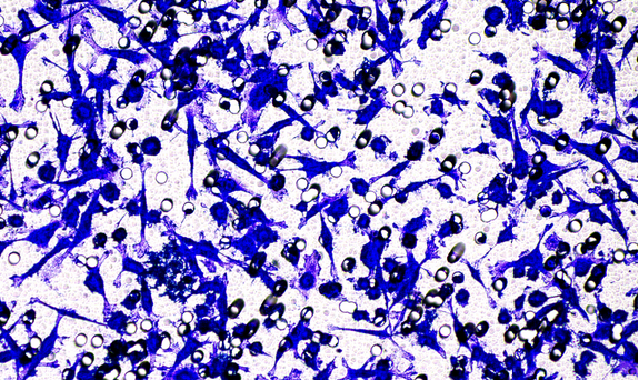 Transwell细胞侵袭检测系统 - 专为难穿过细胞设计的科研解决方案